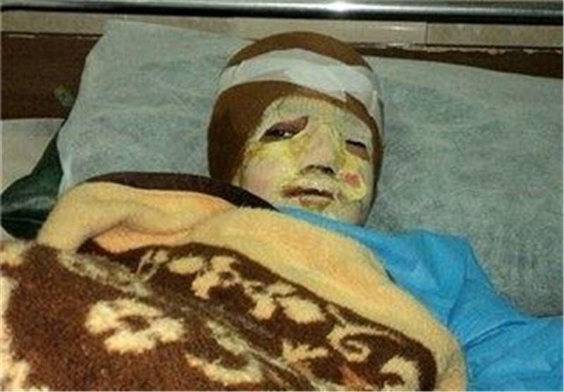 ضدعفونی کننده الکلی